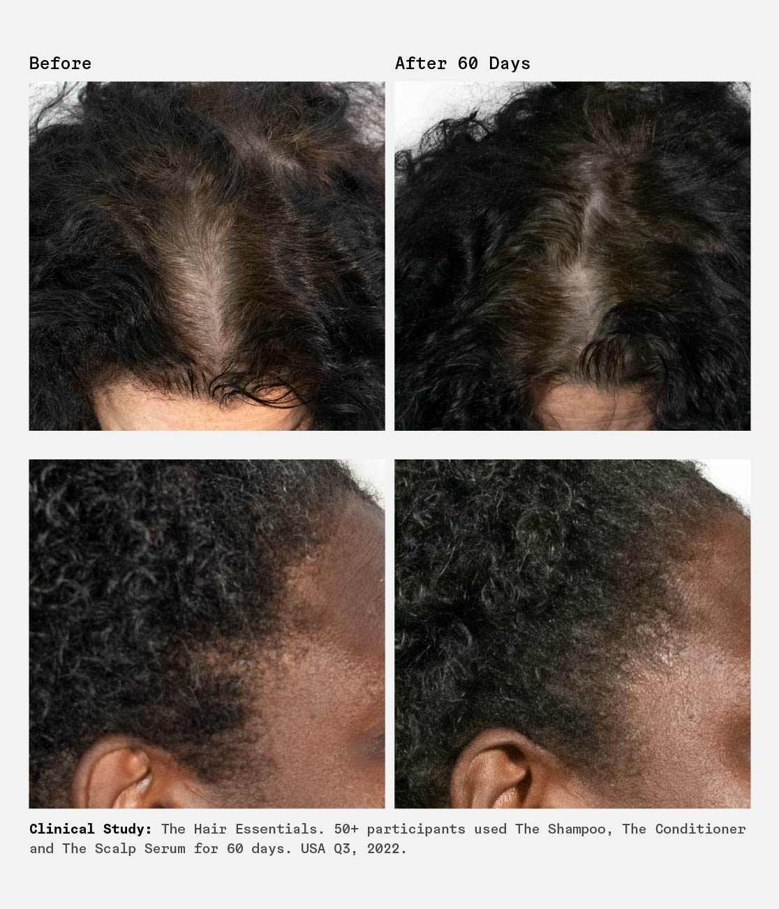 The Scalp Serum Trio | 90-Day Supply | 1% Hyaluronic Acid