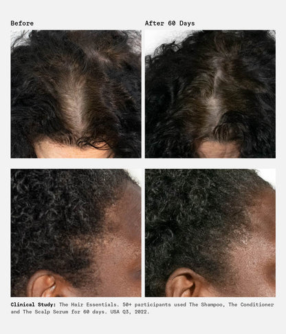 The Scalp Serum Trio | 90-Day Supply | 1% Hyaluronic Acid